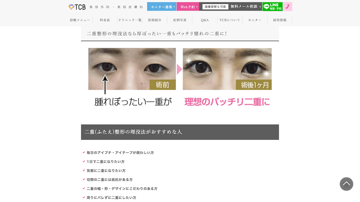 最悪 美容 東京 中央 外科 東京美容外科が「やばい」と噂の理由。管理人も施術してもらいました！